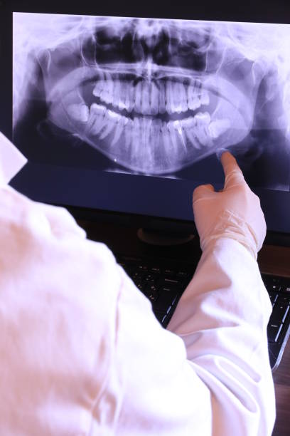 Best Cracked Tooth Emergency Dentist  in Strodes Mills, PA